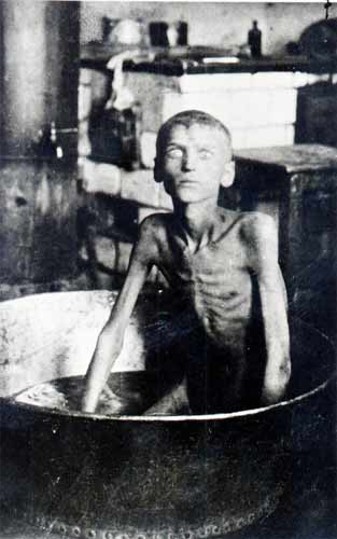 Image -- A starving child during the Famine of 1921-22.