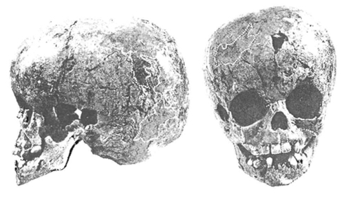 Image -- Starosilia archeological site: a skull of buried Cro-Magnon child with some Neanderthal features.