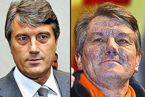 Image -- Viktor Yushchenko (before and after his poisoning).